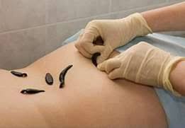 likuvanna nevrologii 3